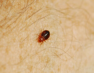 This is a picture of a typical bed bug on your skin